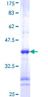 12.5% SDS-PAGE Stained with Coomassie Blue.